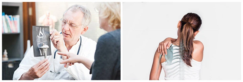 joint disease joint disease